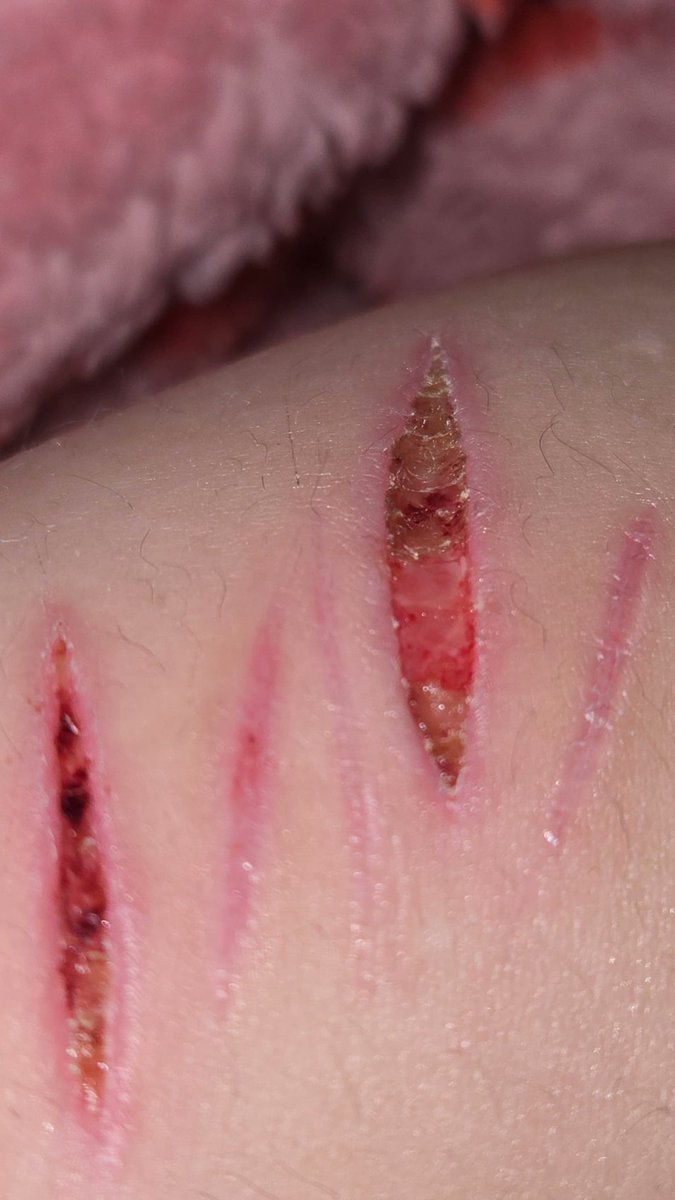 alice ;3 tweet media