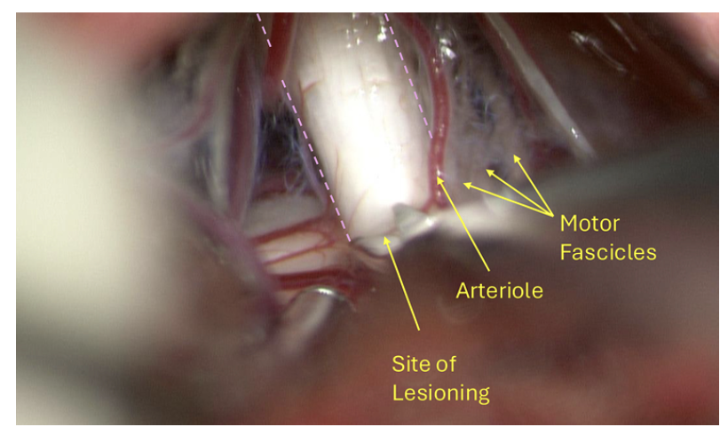 Journal of Neurosurgery tweet media