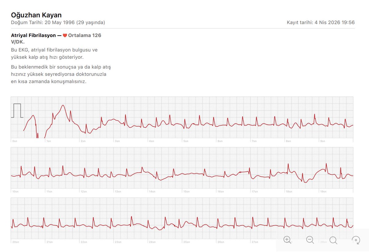 2023 yılında grip olduğum için gittim hastaneye. hipertrofik kardiyomiyopati diye bir hastalığım olduğunu öğrendim. 500 insandan birinde varmış ve hepsi tesadüfen öğreniyormuş. ben de tesadüfen öğrenenlerdenim.

geçen haftasonu evde kedilerle biraz koşturdum. sonrası muhteşem