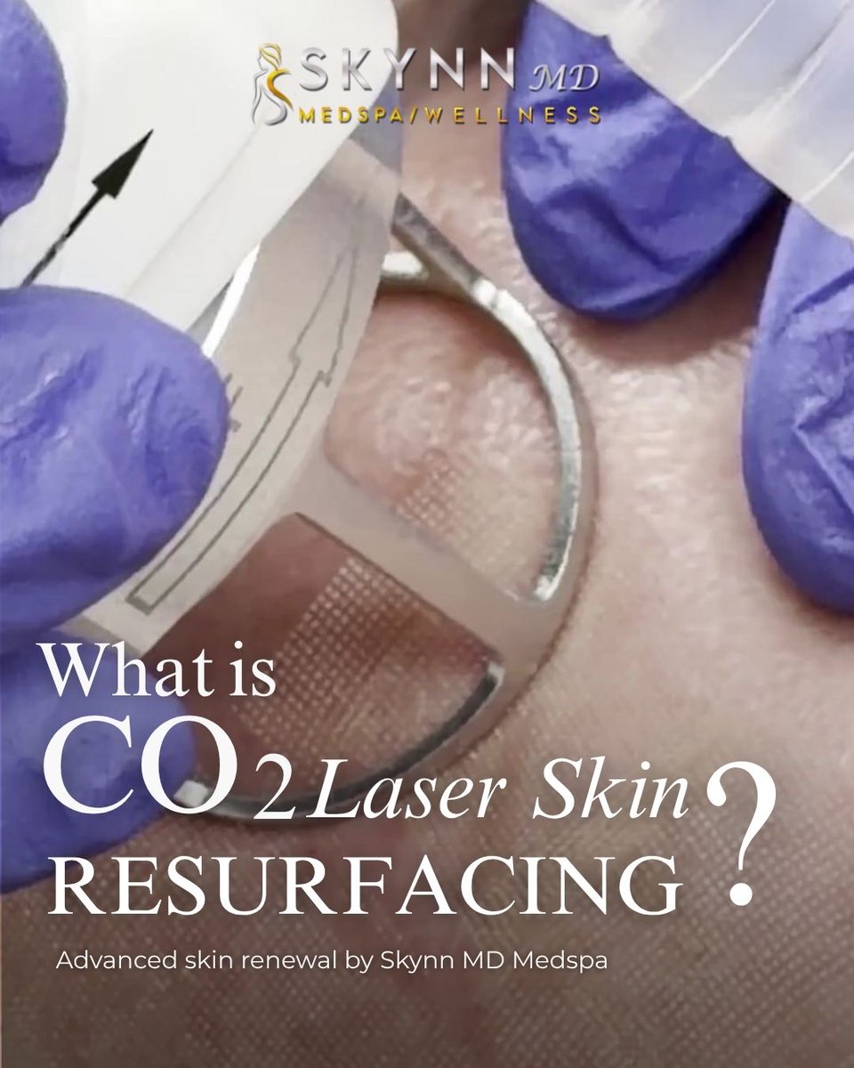 SkynnMD's tweet image. Reveal smoother, brighter, more youthful-looking skin ✨

 Swipe through to learn! 

 #CO2Laser #SkinResurfacing #LaserTreatment #AntiAgingSkin #AcneScars SkinRejuvenation MedspaResults GlowingSkin SkynnMD AdvancedAesthetics