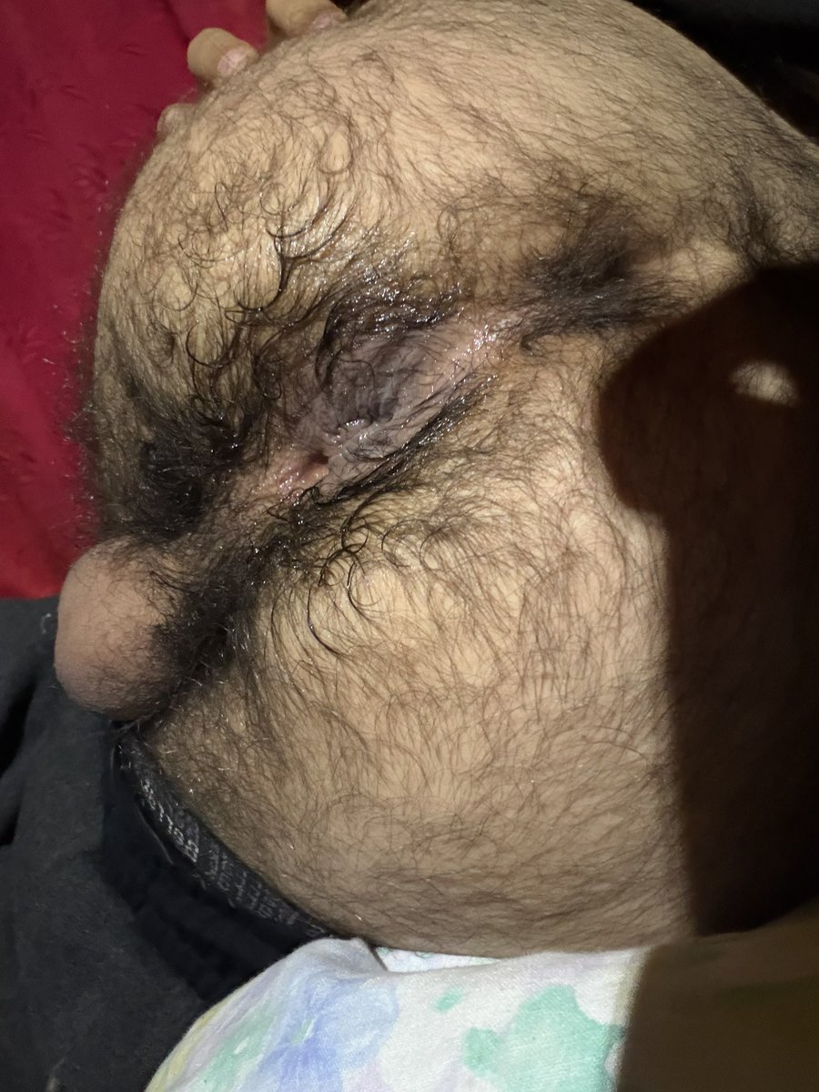 HAİRY BOYS tweet media