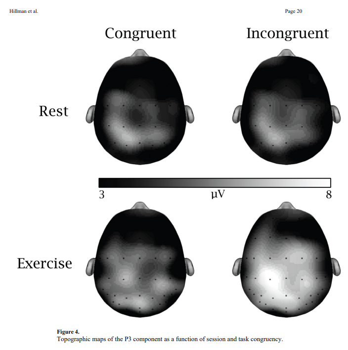 Unilateral Brain Rest Rest Brain vs. Exercise Brain