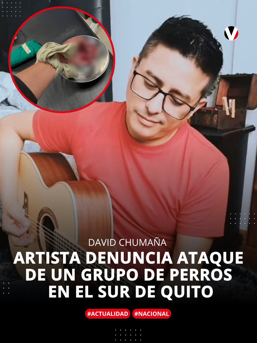 🔴 El artista David Chumaña fue atacado por un grupo de perros cerca de la Asamblea Nacional en Quito. Tras el hecho, acudió a un centro de salud, donde no había vacuna antirrábica disponible. Las autoridades aún investigan la procedencia de los canes. ⚠️ ¿Qué pasó? 👉