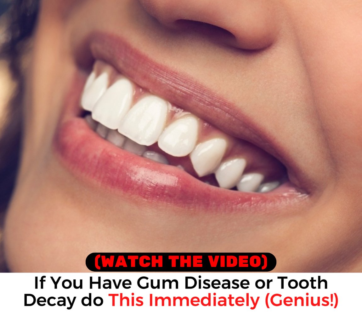 WinJose8's tweet image. #dental #dentalcare #teethgoals #prodentimprobiotic
#teeth #smiles #prodentim #whiteteeth #healthcare  
#OralCare #tooth #decay #viral #DentalHealth
Experience the benefits of our dental
solution and enjoy a healthy mouth.
Click to watch the video👇
👉 f.mtr.cool/xcwlpwoylv 👈