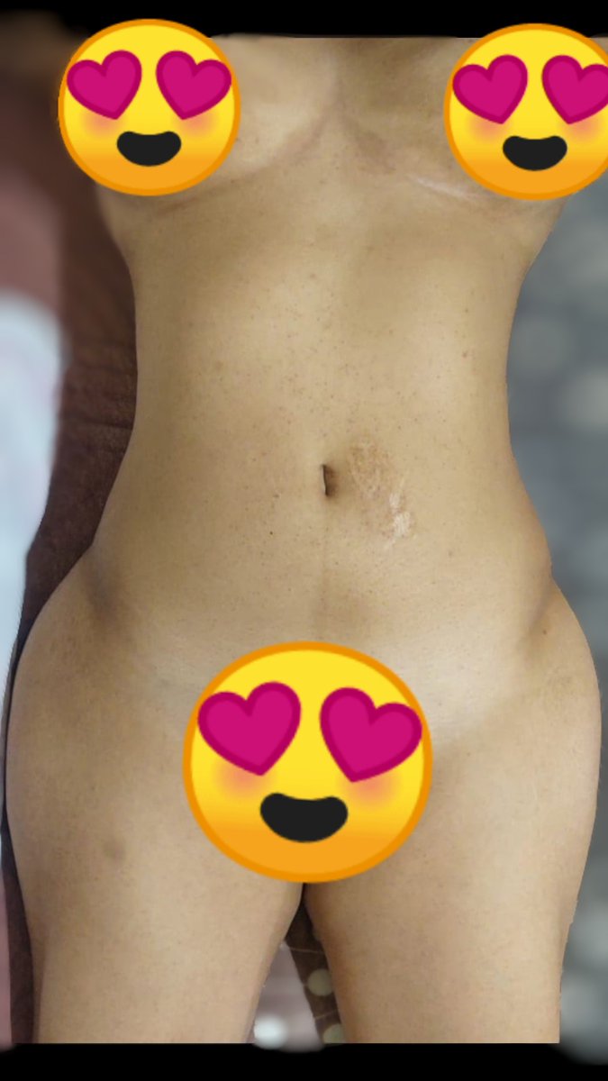 “Atrévete a ver más… lo exclusivo siempre se disfruta mejor 🔥”
fansly.com/post/902717631…
“Aquí empieza la curiosidad… pero allá es donde se cumple 😈”
onlyfans.com/heidiyangel1790
“Gratis para empezar… irresistible para quedarse 😈”