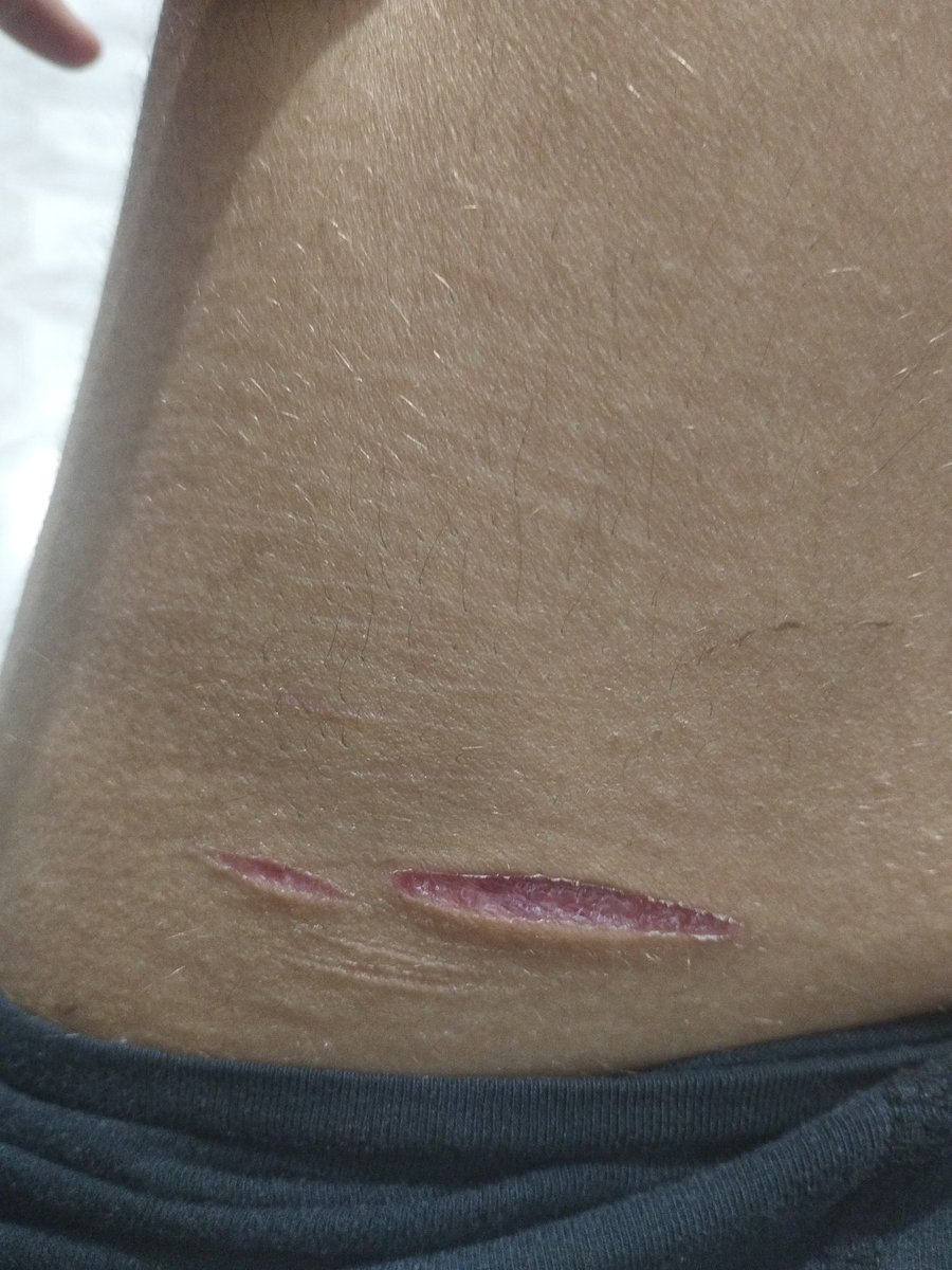 nico (forced sh recovery) tweet media