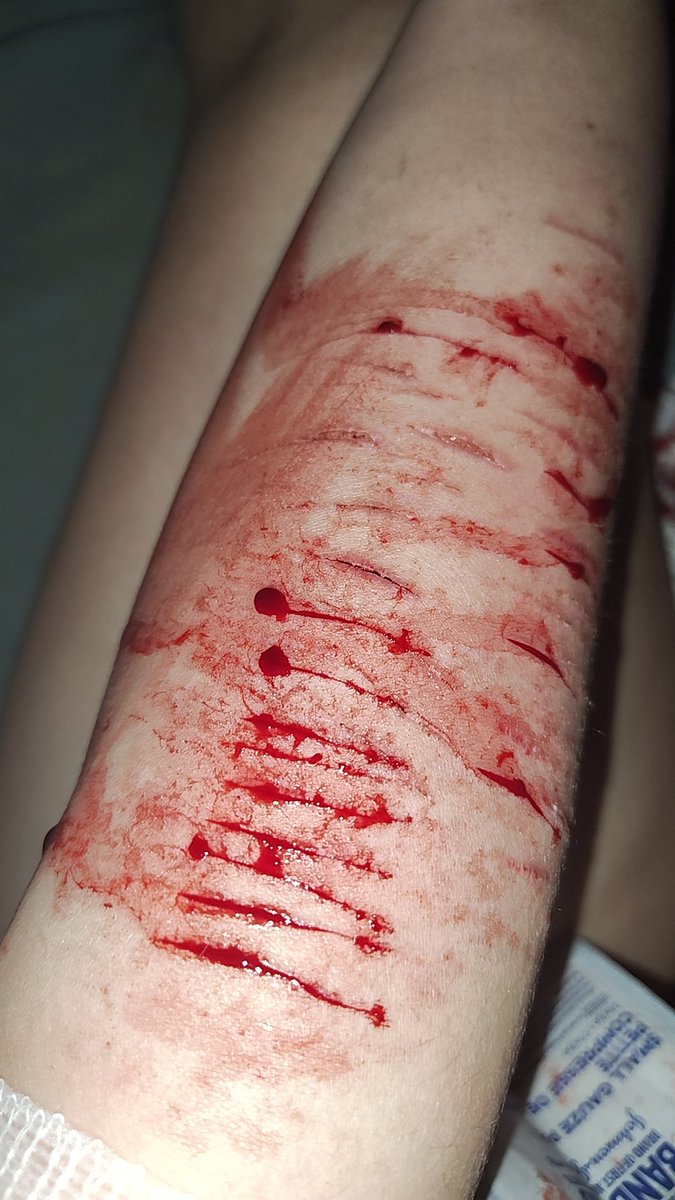 SecretSHaccc's tweet photo. Might do more tonight (i Did this last night)
#shtwt #shedtwt #suicidetwt #988twt #slittwt #styrotwt https://t.co/6TJKvEUa3y