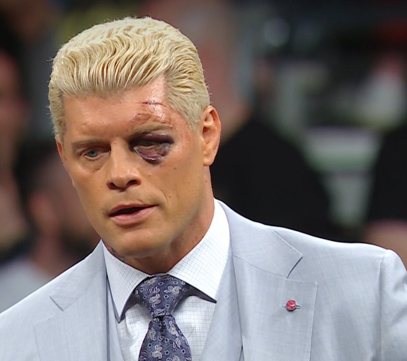 Cody Rhodes’s eye is about to fall off. He gonna cry in the car #WWERAW