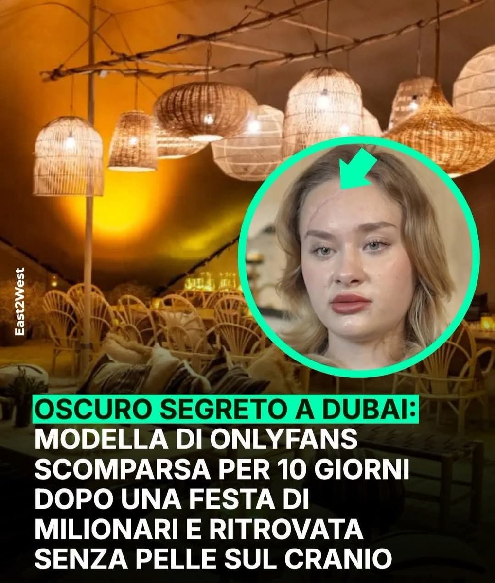 Felyorfelix's tweet image. Leggi #Dubai #portapotty 
Ritrovata abbandonata su un’autostrada:colonna vertebrale e arti completamente frantumati e una parte del cuoio capelluto strappata via

La polizia locale lo ha archiviato dicendo che «è stata una semplice caduta»