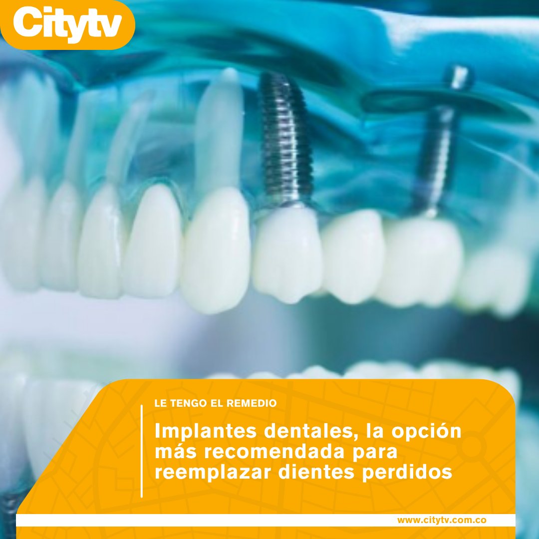 Canal Citytv tweet media