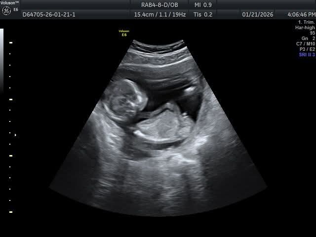 سلطان tweet media