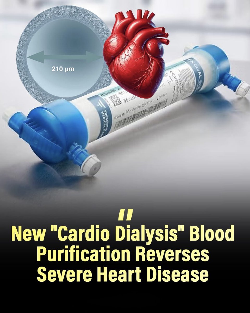 scitechgirl's tweet image. 🚨 WHAT IF YOUR BLOOD COULD BE “WASHED” TO HEAL YOUR HEART?

It sounds unreal… but scientists are testing a new idea called “cardio dialysis.”
Instead of just using pills, this method filters your blood, removing harmful particles, inflammation, and hidden toxins that damage the