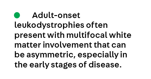 ContinuumAAN's tweet image. Key Point 4 from the article Adult-Onset Leukodystrophies Mimicking Multiple Sclerosis by Gabrielle Macaron and Roberta La Piana from the April #MultipleSclerosis and Related Disorders issue, which is available to subscribers at hubs.la/Q04cbKfv0. #NeuroTwitter #MedEd