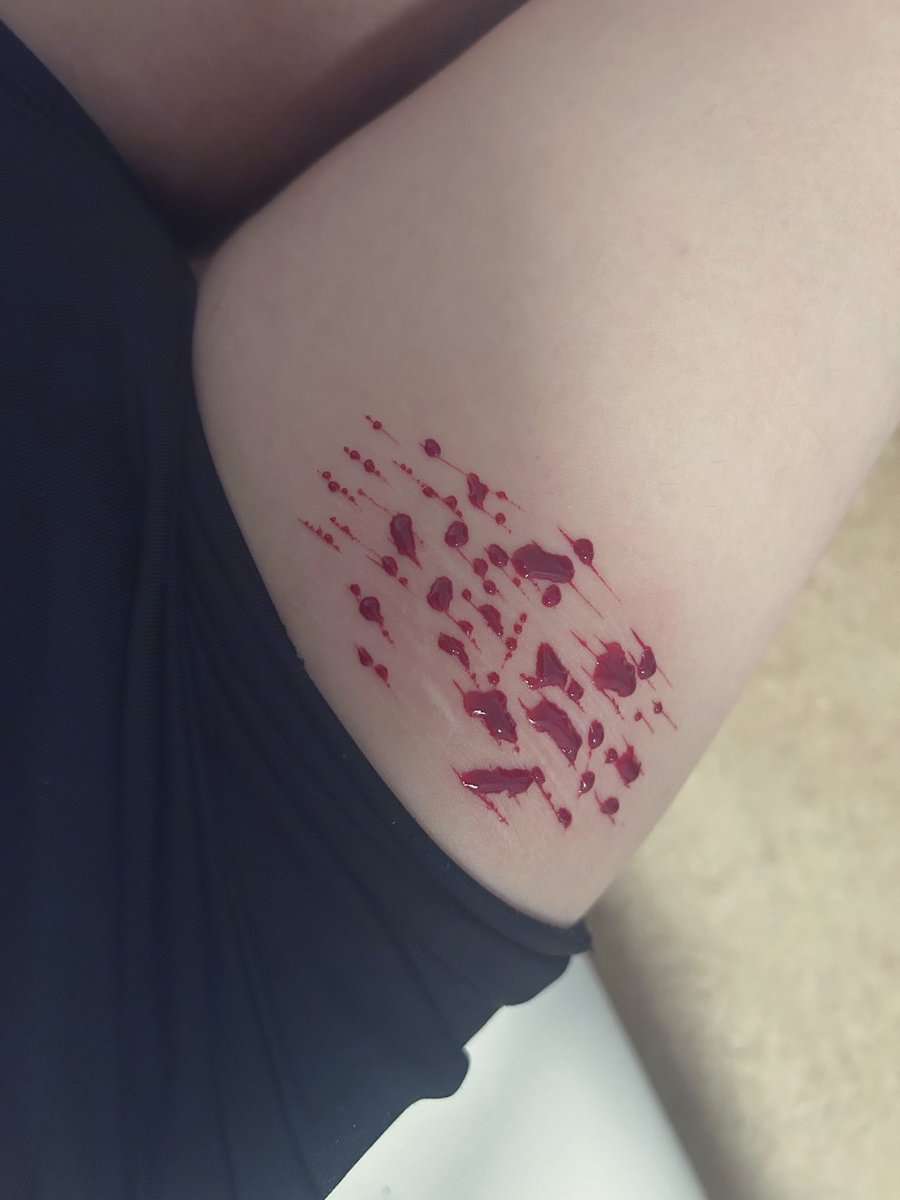 angelsfeeed's tweet photo. FINALLY relapsed after a month jeez #shedtwt #shtwt #catscratches https://t.co/RI2sTZEtCh