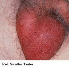 Macmanius's tweet photo. @SteveScaliseGOP insight deez bulbous crimson nutz into ur mouth congressman https://t.co/gg0EjsZHjo