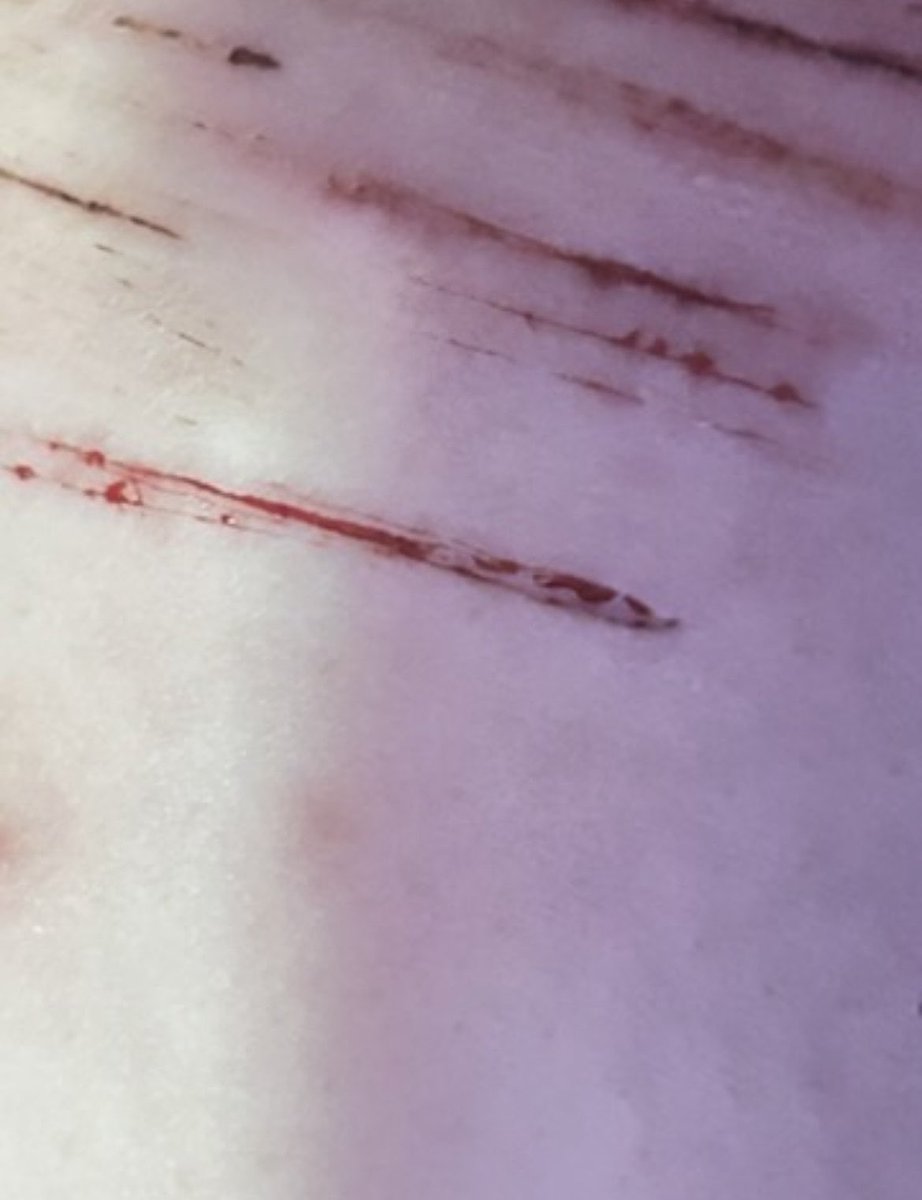 centi - shtwt tweet media