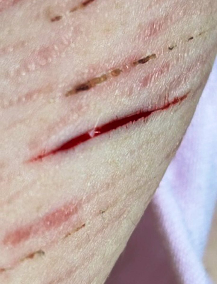 centi - shtwt tweet media