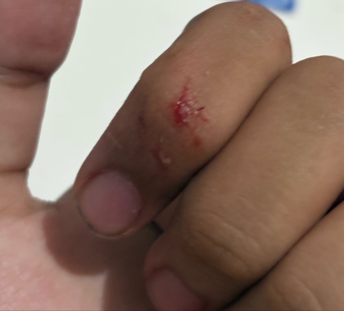 battle scar anak arsi