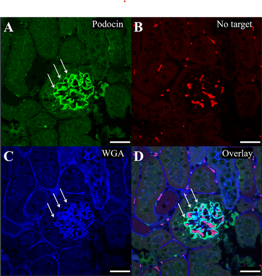 JHCnews's tweet image. JHC's latest article: "Correlating Stimulated Emission Depletion Microscopy With Fluorescence Lifetime Imaging Microscopy to Study the TIE2 Protein on Kidney Glomerular Podocytes."  

Click to read: journals.sagepub.com/doi/abs/10.136… 

#microscopy #FLIM #immunofluorescence