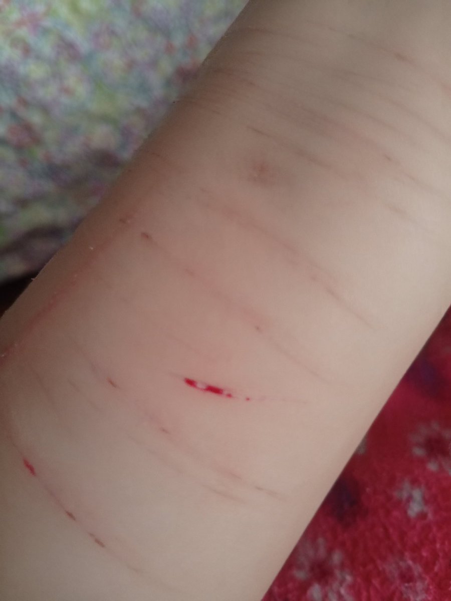 gasolina∆recovery tweet media