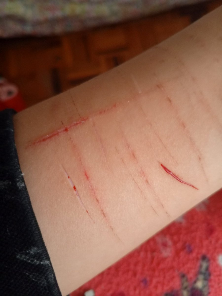 gasolina∆recovery tweet media