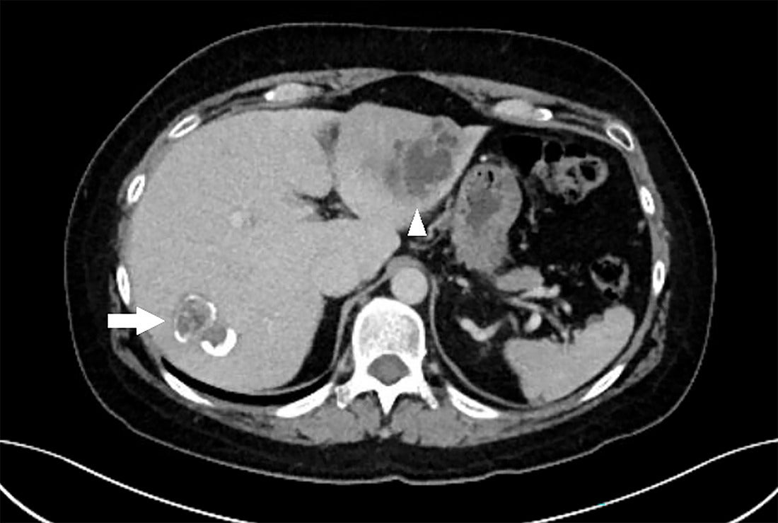 AppliedRadiology tweet media