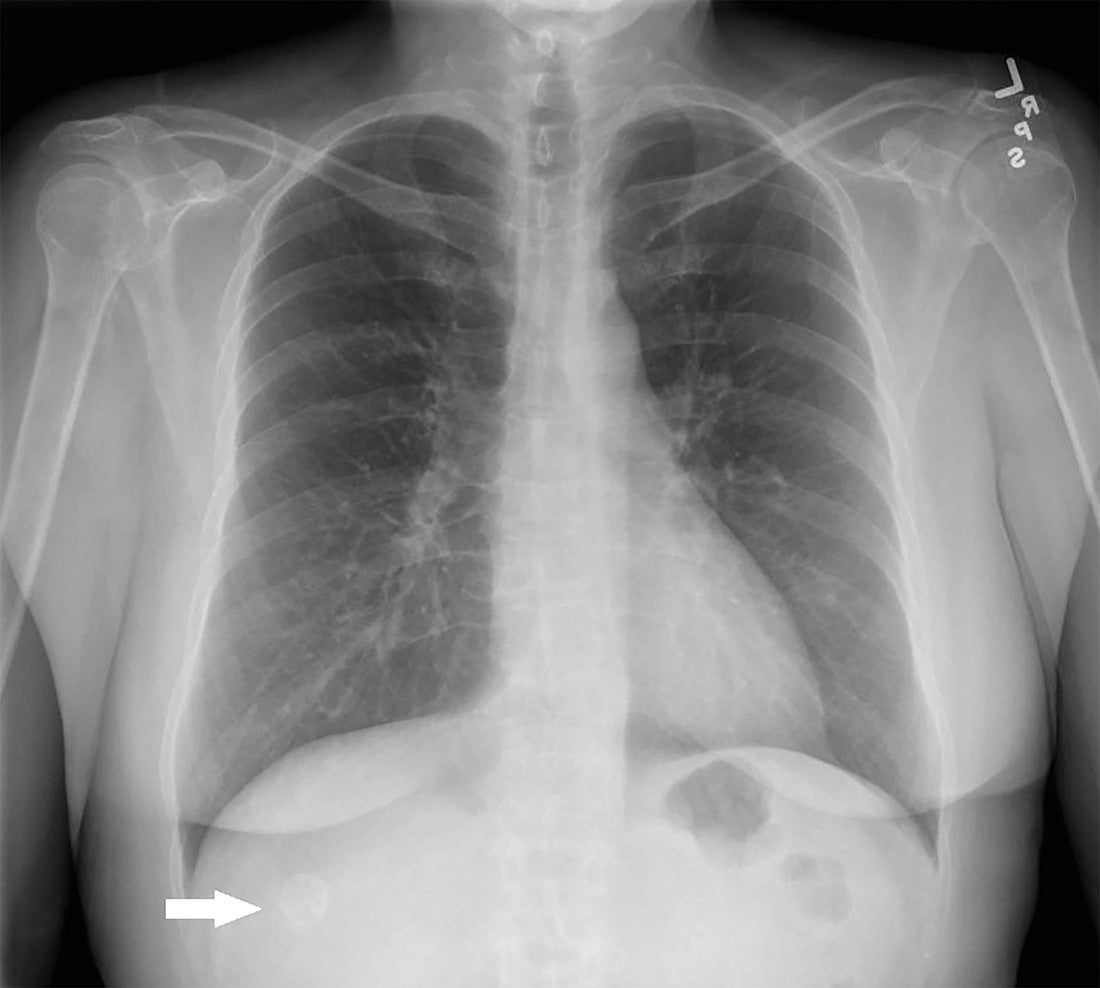 AppliedRadiology tweet media