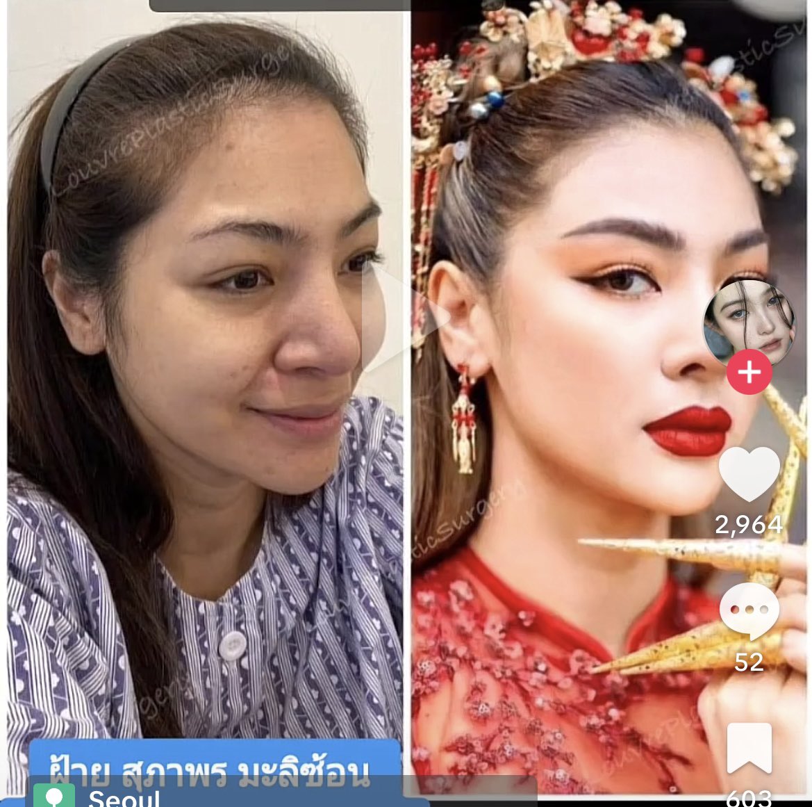 Gerard i barnahegen. tweet media