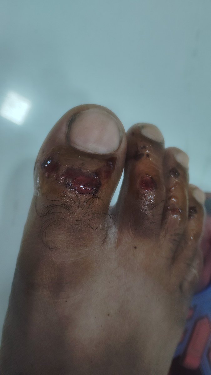 Subhashkar58315's tweet image. "Dear @SwiggyCares, 1 mahina 7 din ho gaye hain. Janch ka jhansa diya ja raha hai taki case purana ho jaye aur muavja na dena pade. Meri ID: 2264174 hai, 2022 se imandari se kaam kar raha hoon. @LabourMinistry @OfficeOf_LMa @PMOIndia #Swiggy #Justice #LabourRights