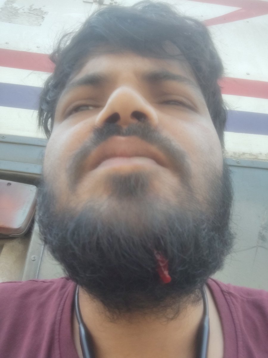 Subhashkar58315's tweet image. "Dear @SwiggyCares, 1 mahina 7 din ho gaye hain. Janch ka jhansa diya ja raha hai taki case purana ho jaye aur muavja na dena pade. Meri ID: 2264174 hai, 2022 se imandari se kaam kar raha hoon. @LabourMinistry @OfficeOf_LMa @PMOIndia #Swiggy #Justice #LabourRights