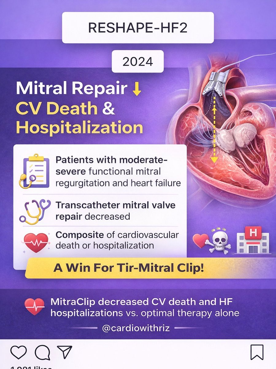 haniriz's tweet image. RESHAPE-HF2 (2024) — High-Yield

Population:
Moderate–severe secondary MR + HF

Intervention:
Transcatheter mitral repair

Outcome:
↓ CV death + ↓ HF hospitalization

📌 Compared with GDMT alone

#CardioWithRiz #Cardiology #HeartFailure #MitralRegurgitation