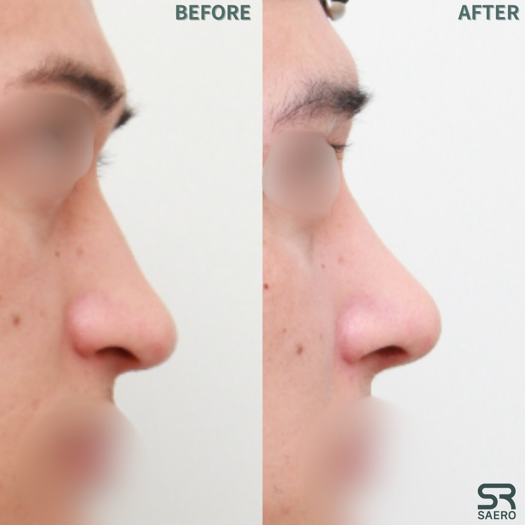 セロ美容外科 tweet media