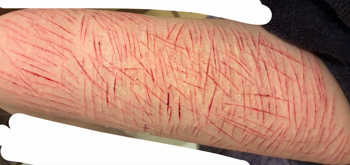 Zooble of shedtwt tweet media