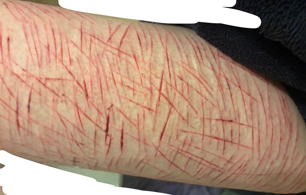 Zooble of shedtwt tweet media