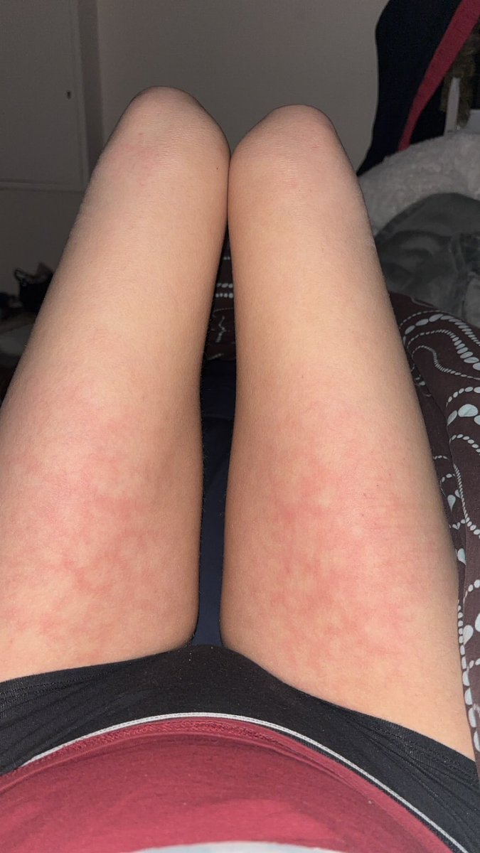 𝄞⨾𓍢ִ໋𝕝𝕦𝕩°❀.ೃ࿔* tweet media