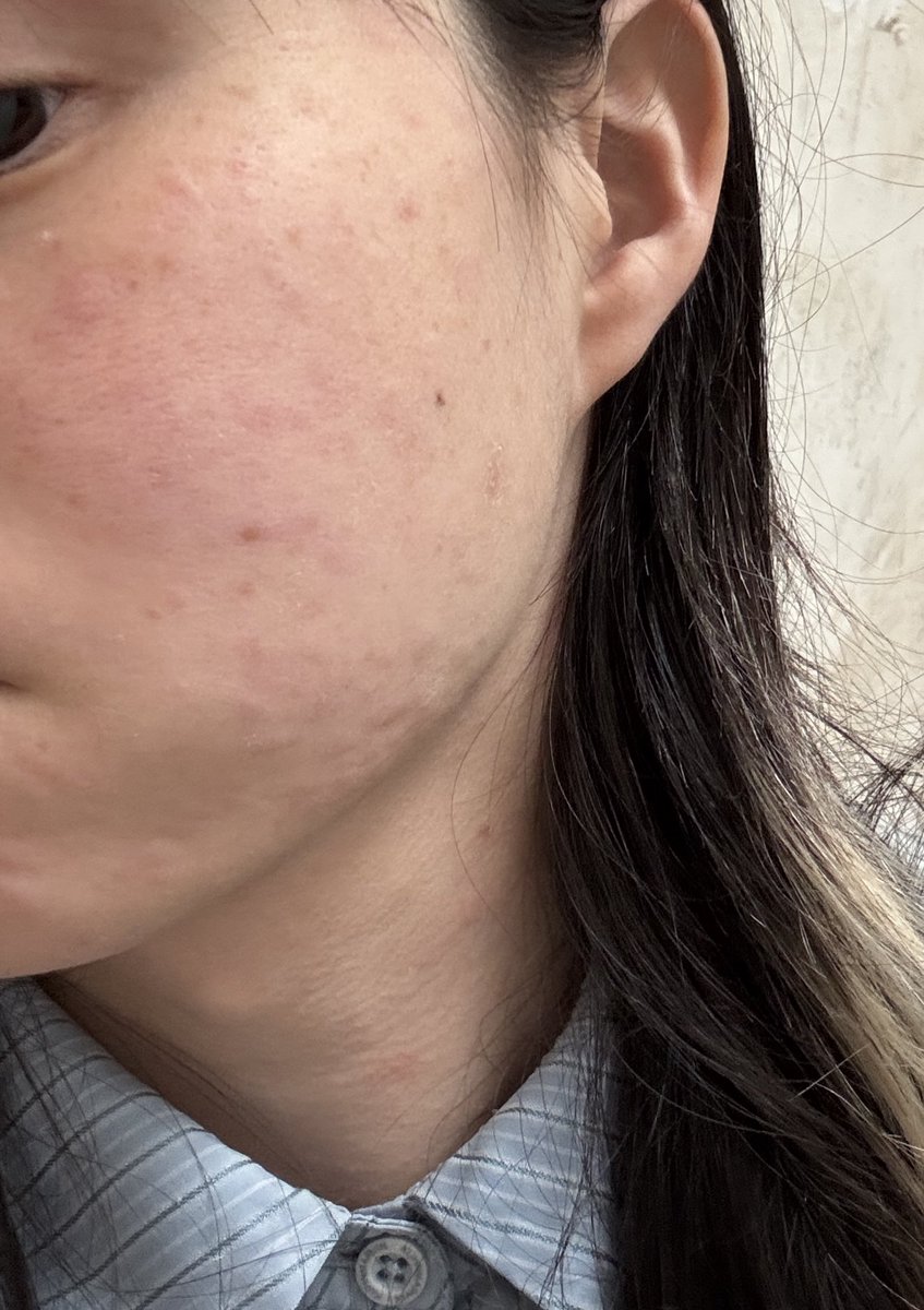 F菌🏳️‍⚧️ tweet media