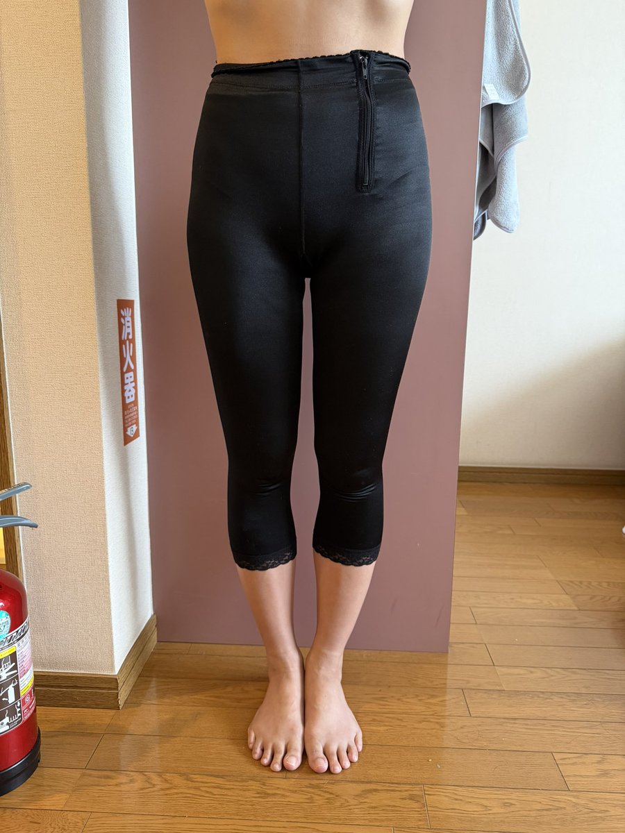 urimaru_xx's tweet photo. 太もも脂肪吸引術後3週間目
数日前まではむくみがすごくて、足首も見えないくらいむくみましたが、いつの間にかスッキリしました！！すでにめっちゃ細いです✨
#レアート整形外科 #ムン院長 https://t.co/gLPTqVmJIF