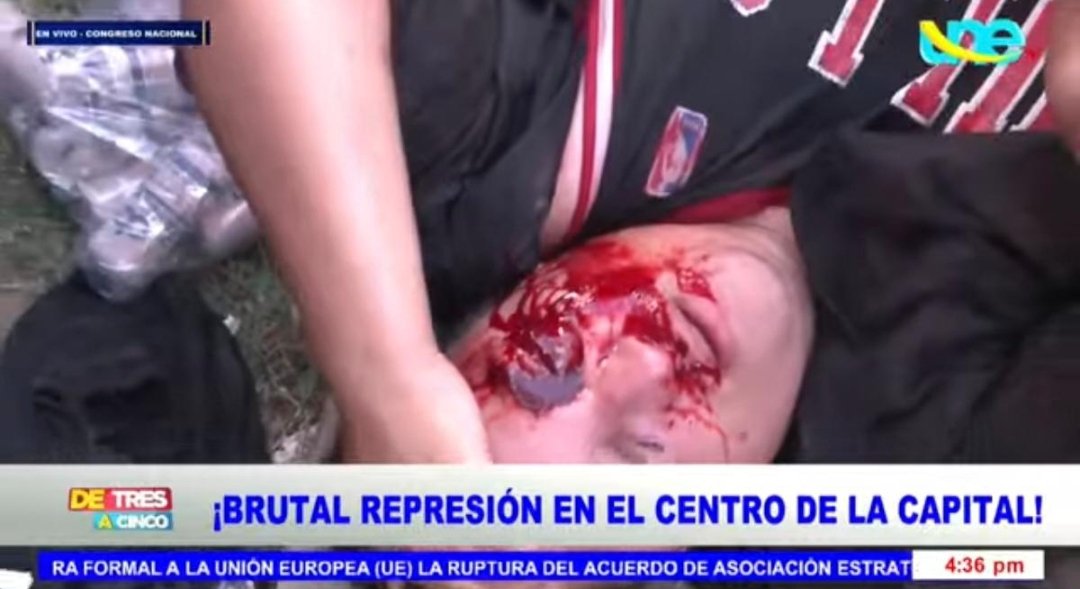 Rony Martinez 🇭🇳 tweet media