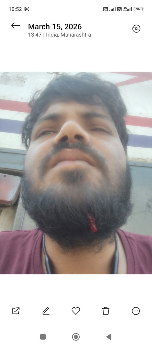 Subhashkar58315's tweet image. Respected @LabourMinistry @OfficeOf_LMa, I'm a #Swiggy partner (ID:2264174) here. After an on-duty accident (16/03), Swiggy blocked my ID on fake fraud charges to deny medical aid. Support misled me &amp;amp; Manager blocked me. Need help! #LabourRights @SwiggyCares #JusticeForGigWorkers