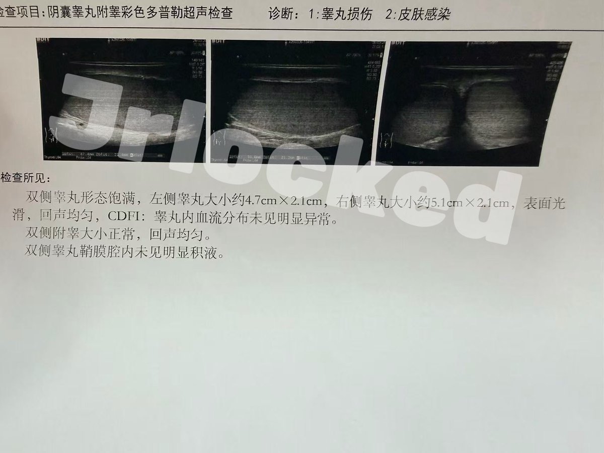 Jrlocked（唧唧被锁版） tweet media