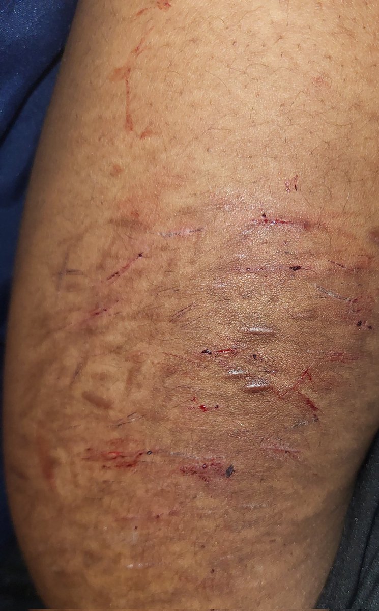 Muu 👑🐝 tweet media