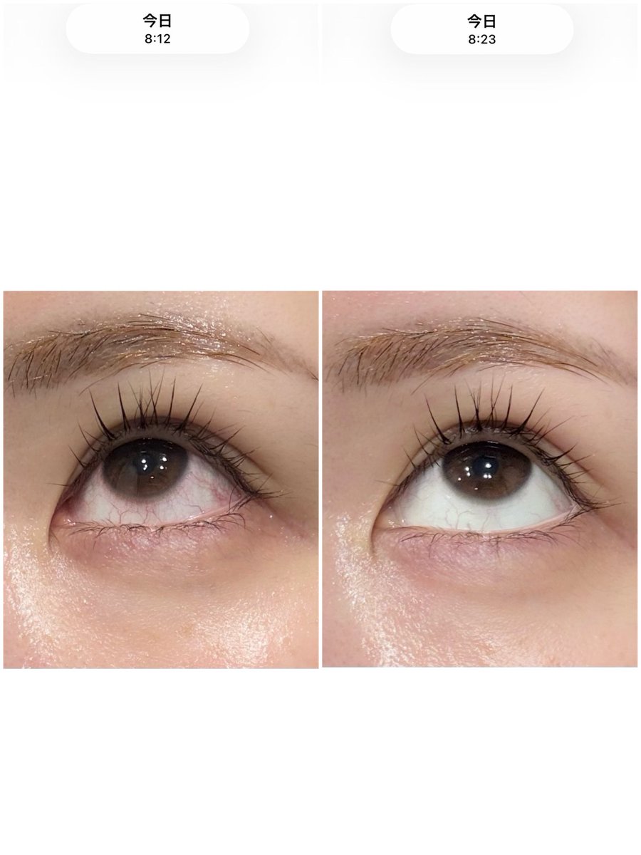 ぱび🍍肌管理ｺｽﾊﾟｵﾀｸ tweet media