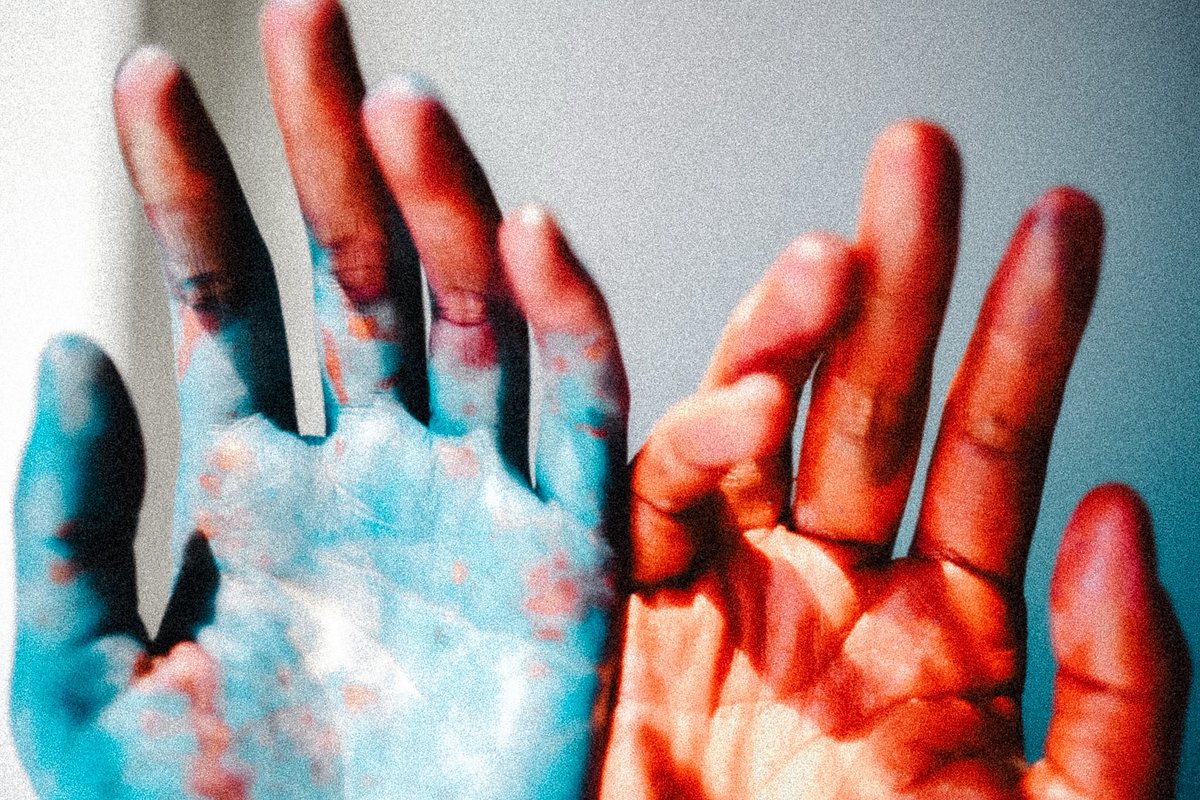 𝙯𝙪𝙥𝙞 tweet media