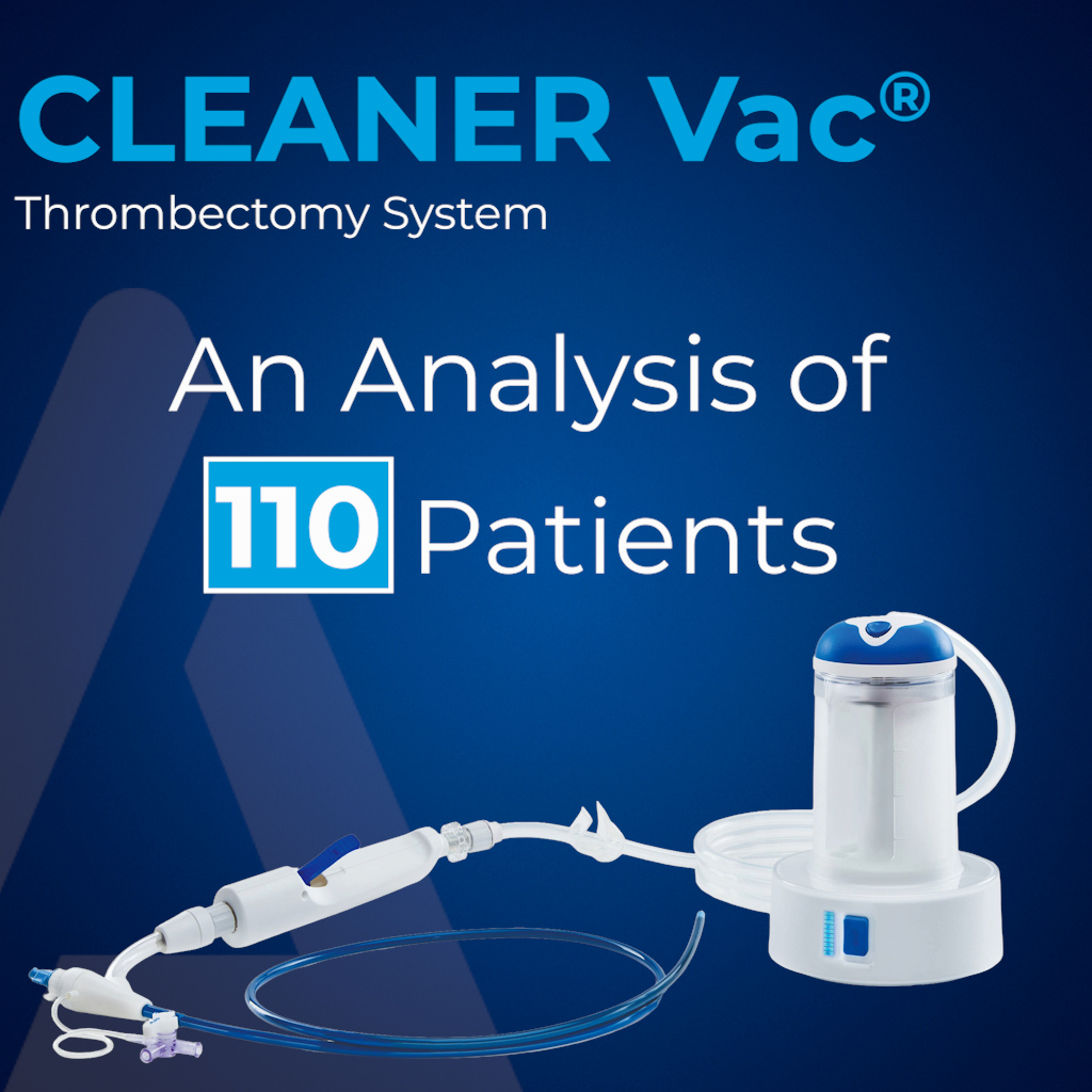 ArgonMedical's tweet image. 110 procedures were evaluated in a new multicenter, retrospective analysis of the CLEANER Vac® #Thrombectomy System.

The study highlights real-world experience with CLEANER Vac in the treatment of venous thrombosis, including clot clearance outcomes and procedural insights.