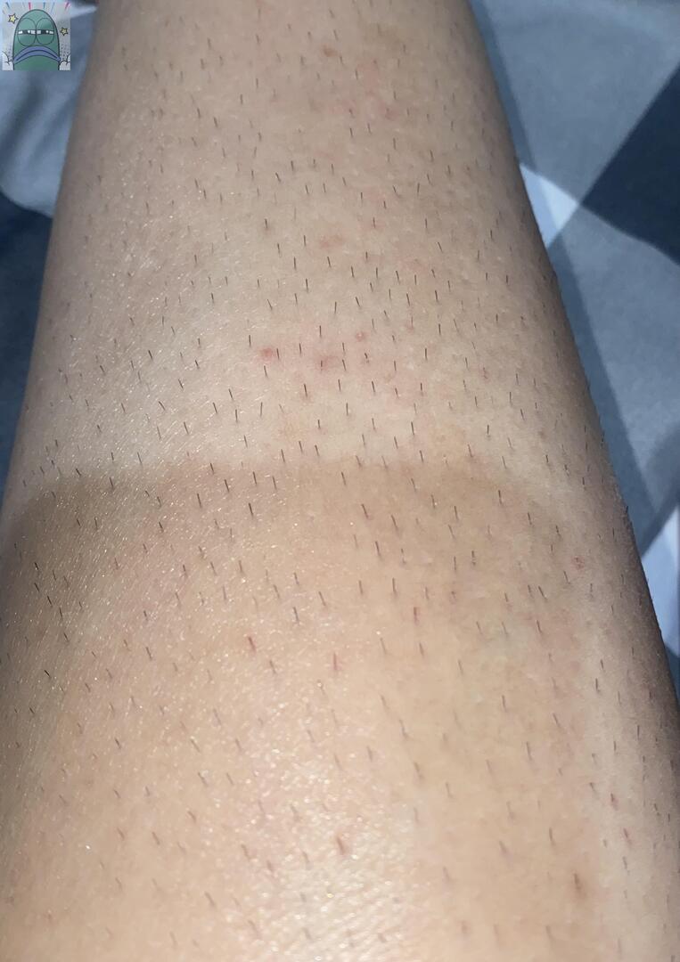 Tanyarlfes tweet media