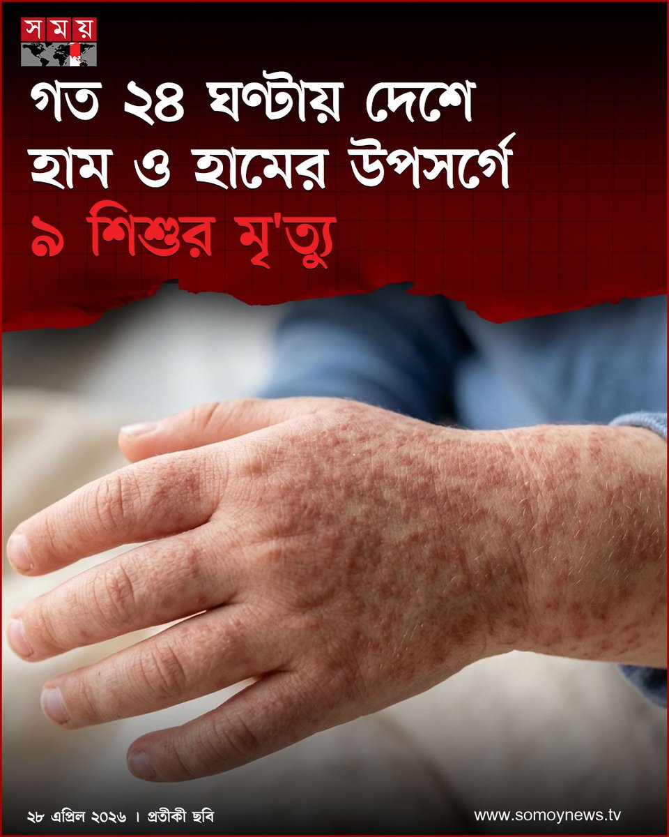 somoytv's tweet image. দেশে হাম ও হামের উপসর্গে গত ২৪ ঘণ্টায় আরও ৯ শিশু মা'রা গেছে। এর মধ্যে তিন শিশুর হাম শনাক্ত হয়েছিল। হামের উপসর্গ ছিল ছয় শিশুর মধ্যে

বিস্তারিত : somoynews.tv/news/2026-04-2…

#national #news #somoytv