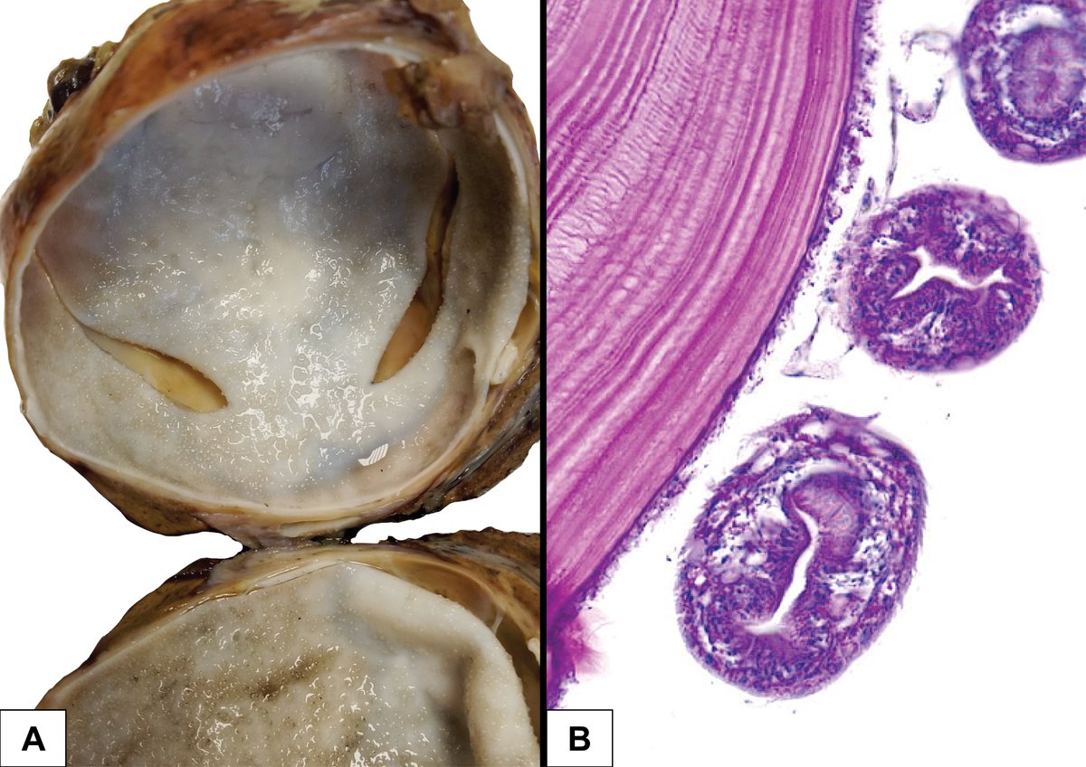 European Society of Pathology (ESP) tweet media