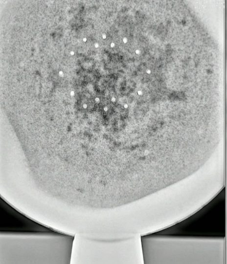 Buga Sphere Anomaly, an early warning system? Plus x-ray internal ...