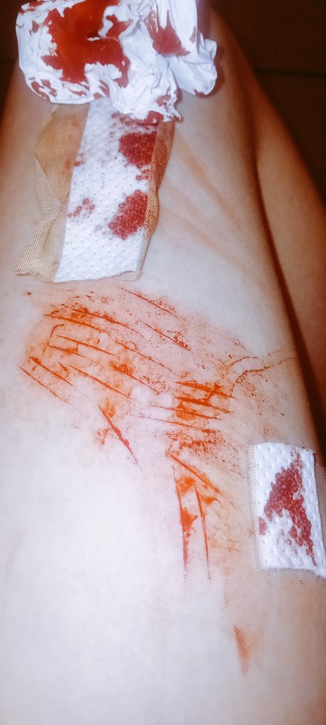 scootaloomf's tweet photo. SESH mini styros pls correct me if im wrong FAKE SFX BUT WHO CARES gotta start building my pain tolerance back HELP PLEASE I THINK MY EX GF IS IN THE STALL NEXT TO ME IN SILENCE WHAT IF SHES CUTTING TOO https://t.co/tDSsscJ84A