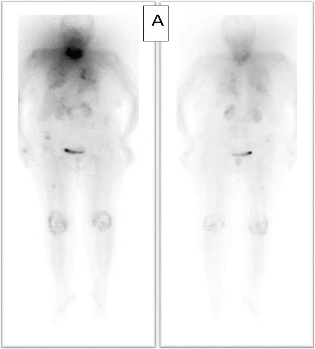 Clinical Nuclear Medicine tweet media